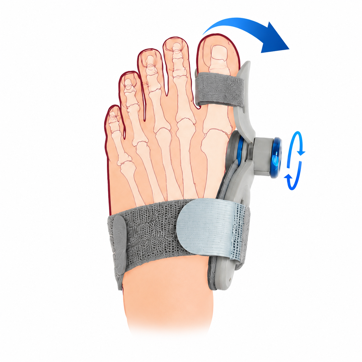 StrideGuard Bunion Corrector on a foot